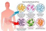 IBD effects and treatments