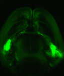photo - An entire mouse brain viewed from above: neuronal extensions connect the two amygdalas (brightest spots on both sides of the brain) with the prefrontal cortex (top)